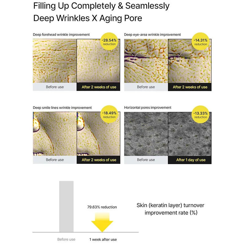 Retinol Firming Eye Cream: verwijdert fijne lijntjes, verwijdert oogzakken en hydrateert de huid rond de ogen